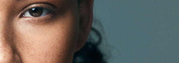 What Is Combination Skin?